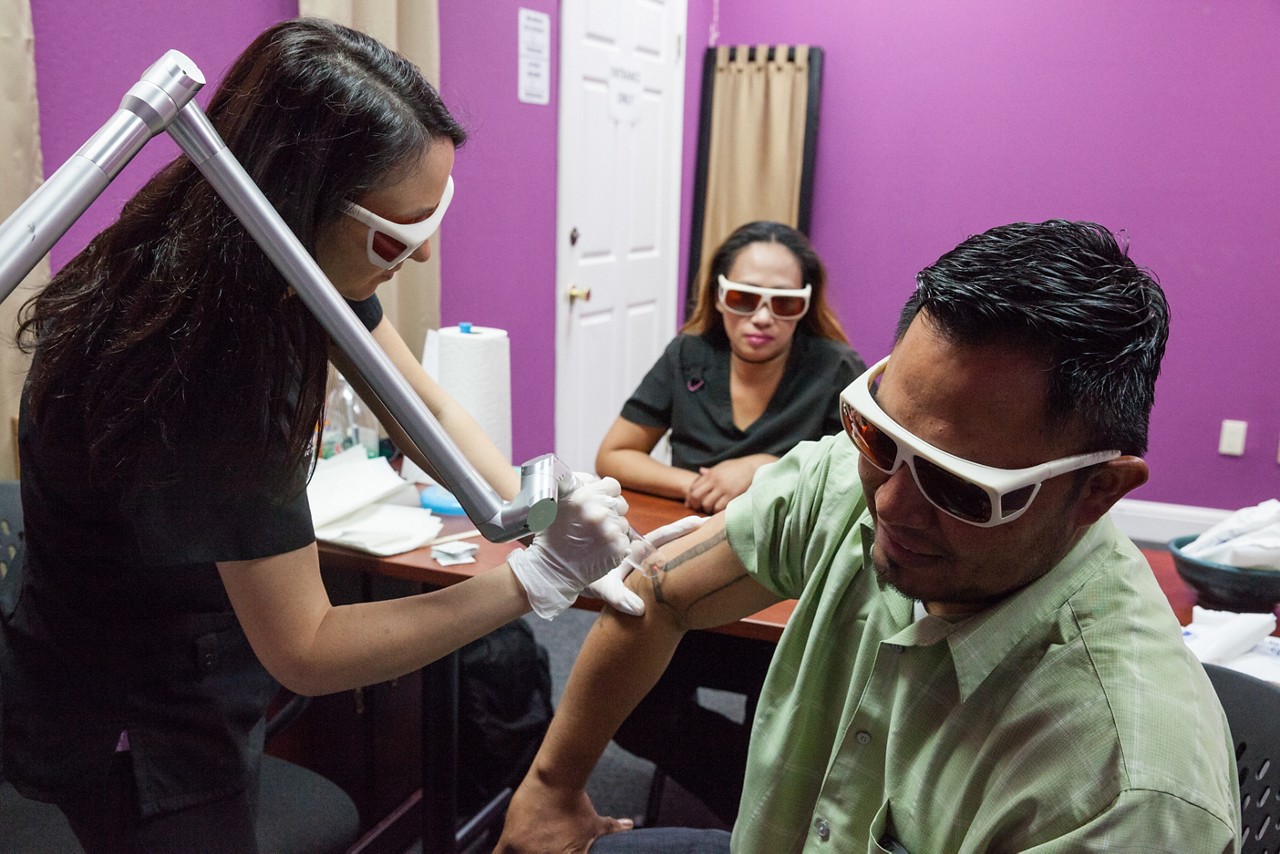 A woman removing a tattoo from a man's arm. 